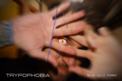 Trypophobia by Dr. Cyril Thomas